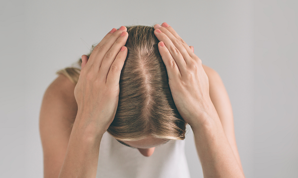 Što izaziva i kako spriječiti opadanje kose?